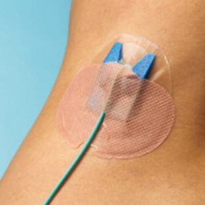Catheter Securement Devices – ISIPS